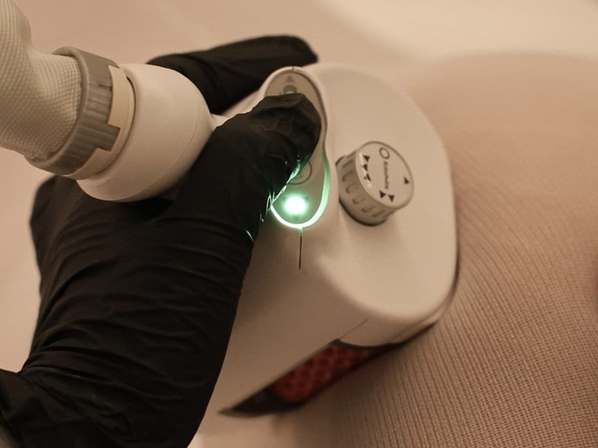 A gloved hand guiding an Icoone handpiece across a client's body, its green indicator light on